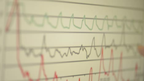 Nahaufnahme-Eines-Fingers,-Der-Auf-Schwankende-Liniendiagramme-Auf-Einem-Digitalen-Monitor-Zeigt,-Geringe-Schärfentiefe