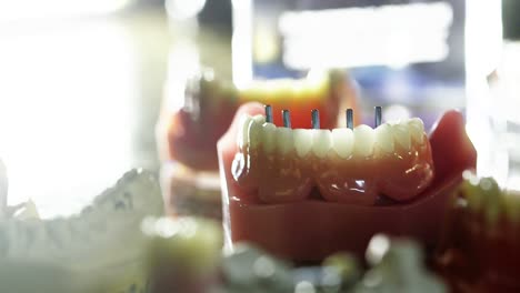 Several-models-of-teeth-with-implant-rods-shot-with-dramatic-low-key-lighting