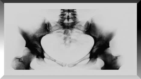 Medical-xrays