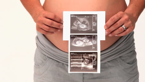 Pregnant-woman-holding-a-scan-