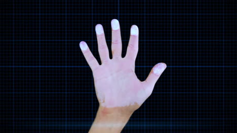 Animation-Einer-Hand,-Die-Einer-Röntgenuntersuchung-Unterzogen-Wird-