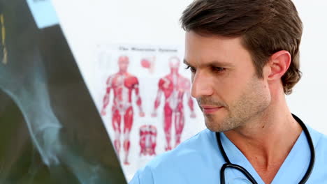 Handsome-nurse-examining-an-xray