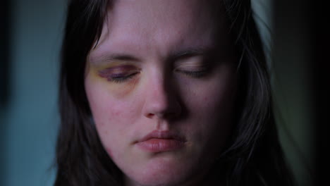 Close-up-of-scared-and-terrified-woman-with-bruised-eye-about-to-start-crying