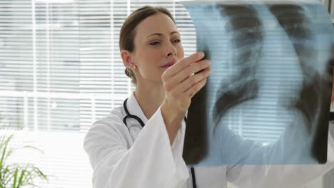 Doctor-examining-chest-xray