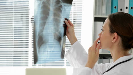 Doctor-examining-chest-xray