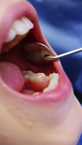 Dentist-examining-a-young-patient-with-tools