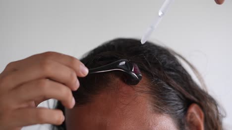 man-using-roller-hair-on-his-scalp-to-prevent-baldness,-Hair-thinning