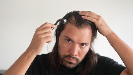 man-wearing-roller-hair-on-his-head-to-prevent-baldness,Minoxidil