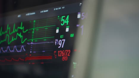 Close-up-of-a-patient-monitoring-system