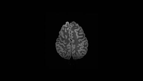 Mri-Brain-Scan,magnetic-Resonance-Imaging-Of-A-Brain,-Full-HD,-Time-Lapse