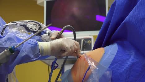 Shoulder-arthroscopy-is-surgery-that-uses-a-tiny-camera-called-an-arthroscope-to-examine-or-repair-the-tissues-inside-or-around-your-shoulder-joint