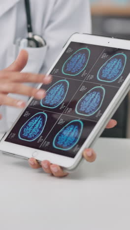 Person,-Hände-Und-Arzt-Auf-Tablet-Mit-Gehirnscan