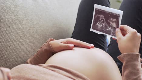 Eine-Junge-Schwangere-Frau-Mit-Einem-Ultraschall-An-Ihren-Händen