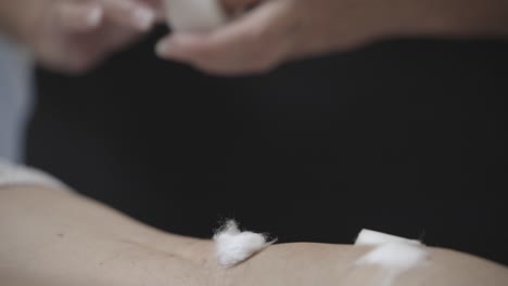 Doctor's-Hands-Holding-Micropore-Tape-Next-To-A-Patient-During-Sclerotherapy-Treatment