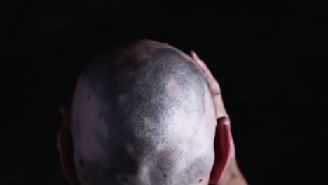 Cancer-victim-with-bald-head-feeling-stress,-dark-room,-macro-dolly-shot