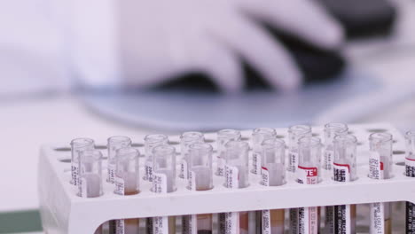 Test-tube-rack-filled-with-COVID-19-coronavirus-testing-samples-in-a-medical-facility