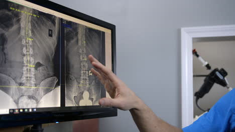 A-Chiropractor-explains-x-rays-to-a-patient