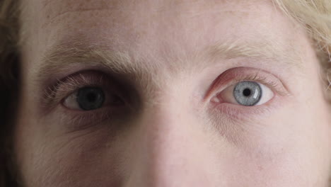 Nahaufnahme-Eines-Mannes-Mit-Blauen-Augen,-Der-Einen-Kaukasischen-Mann-öffnet,-Der-Wach-Ist-Und-In-Die-Kamera-Schaut,-Iris-Fokus-Makro