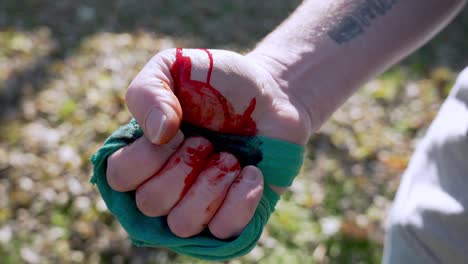 Man-closes-hand-with-tightened-textile-to-stop-the-bleed,-Blurred-grass-background