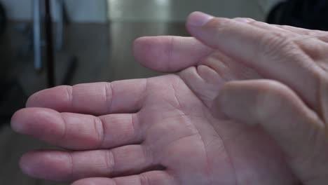 Ein-Kaukasischer-Mann-Schmiert-Salbe-Auf-Eine-Mit-Ekzemen-Bedeckte-Handfläche