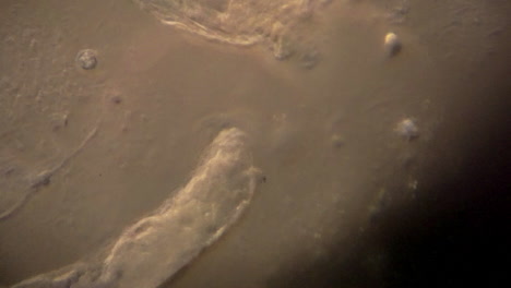 Microscopic-rotifers-feed-and-move-about