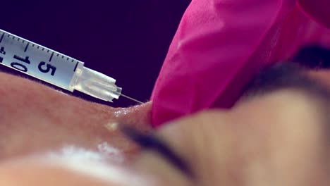 Primer-Plano-De-Una-Mujer-Que-Recibe-Terapia-De-Tratamiento-Con-Inyecciones-De-Botox