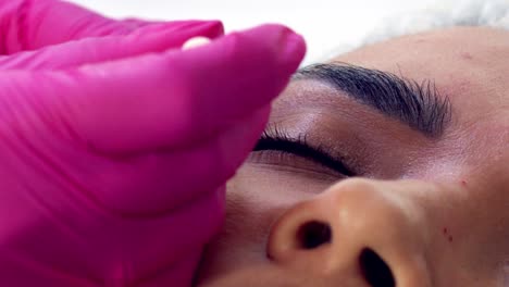 Latina-woman-getting-Botox-injections---close-up-face