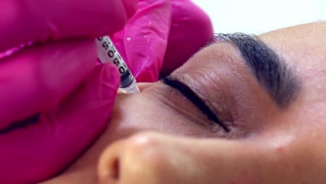 Hispanische-Frau-Bekommt-Botox-Injektionen-–-Nahaufnahme