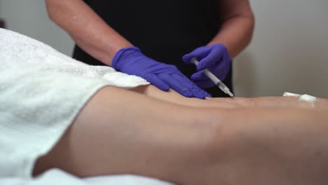 Sclerotherapy