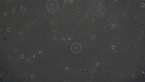 Spermien-Durch-Ein-Mikroskop-Gesehen