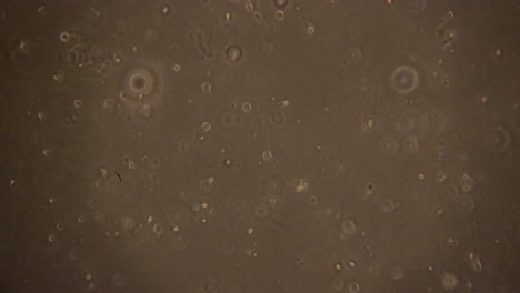 Absterben-Von-Samenzellen,-Nachdem-Die-Befruchtung-Einer-Eizelle-Fehlgeschlagen-Ist