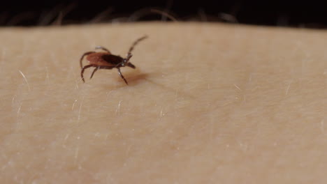 Parasitic-tick-walks-over-caucasian-skin-with-front-legs-up,-closeup-tracking