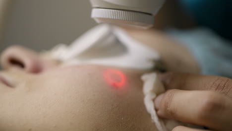 Cosmetic-procedure-with-a-laser
