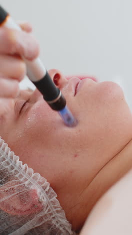 Cosmetóloga-Realizando-Un-Procedimiento-De-Exfoliación,-Regeneración-De-La-Piel-De-La-Mujer,-Microagujas-Dermapen,-Dermastamp