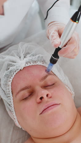 Cosmetóloga-Realizando-Un-Procedimiento-De-Exfoliación,-Regeneración-De-La-Piel-De-La-Mujer,-Microagujas-Dermapen,-Dermastamp