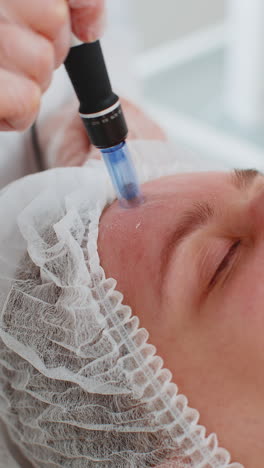 Cosmetologist-doing-peeling-procedure,-woman-skin-regeneration,-dermapen-microneedling,-dermastamp