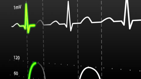 Animation-of-schematic-Intensive-Care-Unit-monitor-showing-normal-values-for-vital-signs,-starting-with-cardiac-frequency.-Dark-blue-backgound.-Perfect-for-any-medical-related-purposes.