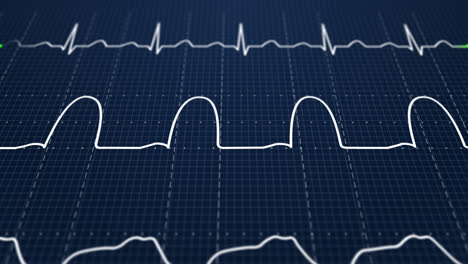 Animation-Eines-Schematischen-Monitors-Einer-Intensivstation,-Der-Normale-Werte-Für-Vitalfunktionen-Zeigt,-Beginnend-Mit-Der-Herzfrequenz.-Dunkelblauer-Hintergrund.-Perfekt-Für-Alle-Medizinischen-Zwecke.