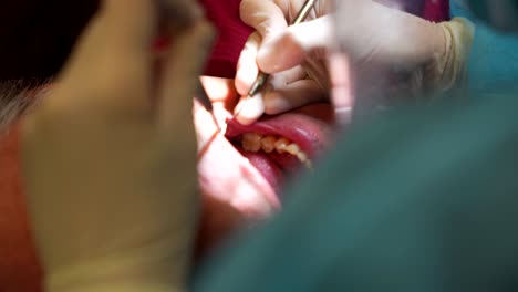 Patient's-mouth-open-while-odontologist-removes-insulating-layer-to-put-piece-of-denture