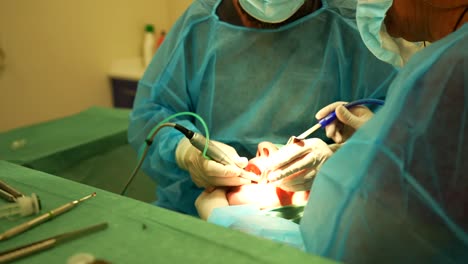 Male-dentist-using-drill-machine-for-a-patient's-treatment-while-receiving-support-from-his-assistant