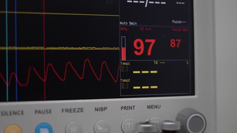 Monitor-Im-Operationssaal,-Patientenpulse