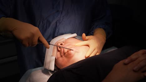Liposucción-De-Papada,-Cirugía-En-Quirófano,-Médico-Operando-Cirugía-Estética-Facial,-Operación-De-Obesidad,-Succión-De-Grasa-Del-Cuerpo,-Exceso-De-Grasa