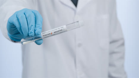 Close-Up-Shot-of-Medical-Professionals-Hand-Holding-Positive-COVID-Test-Tube-Result-
