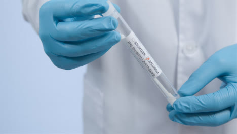 Close-Up-Shot-of-Medical-Professionals-Hands-Holding-COVID-Test-Tube-with-Positive-Result