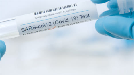 Extreme-Close-Up-Shot-of-Medical-Professionals-Hand-Holding-a-COVID-Test-Tube-Reading-Positive-Result