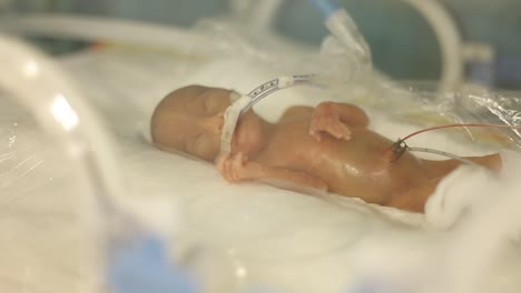 Premature-Baby-in-the-Tub