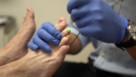 Woman-getting-a-laser-treatment-for-her-foot-nails-in-a-paediatric-clinic