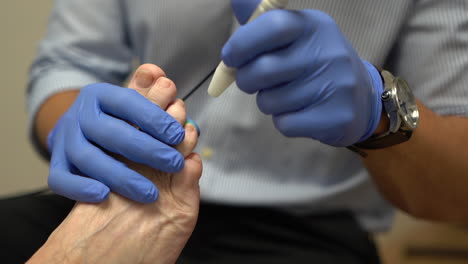 Woman-getting-a-laser-treament-for-her-foot-nails-in-a-paediatric-clinic