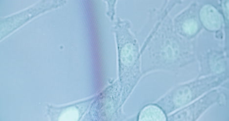 Nahaufnahme-Von-Bakterien,-Die-Sich-Unter-Dem-Mikroskop-Bewegen