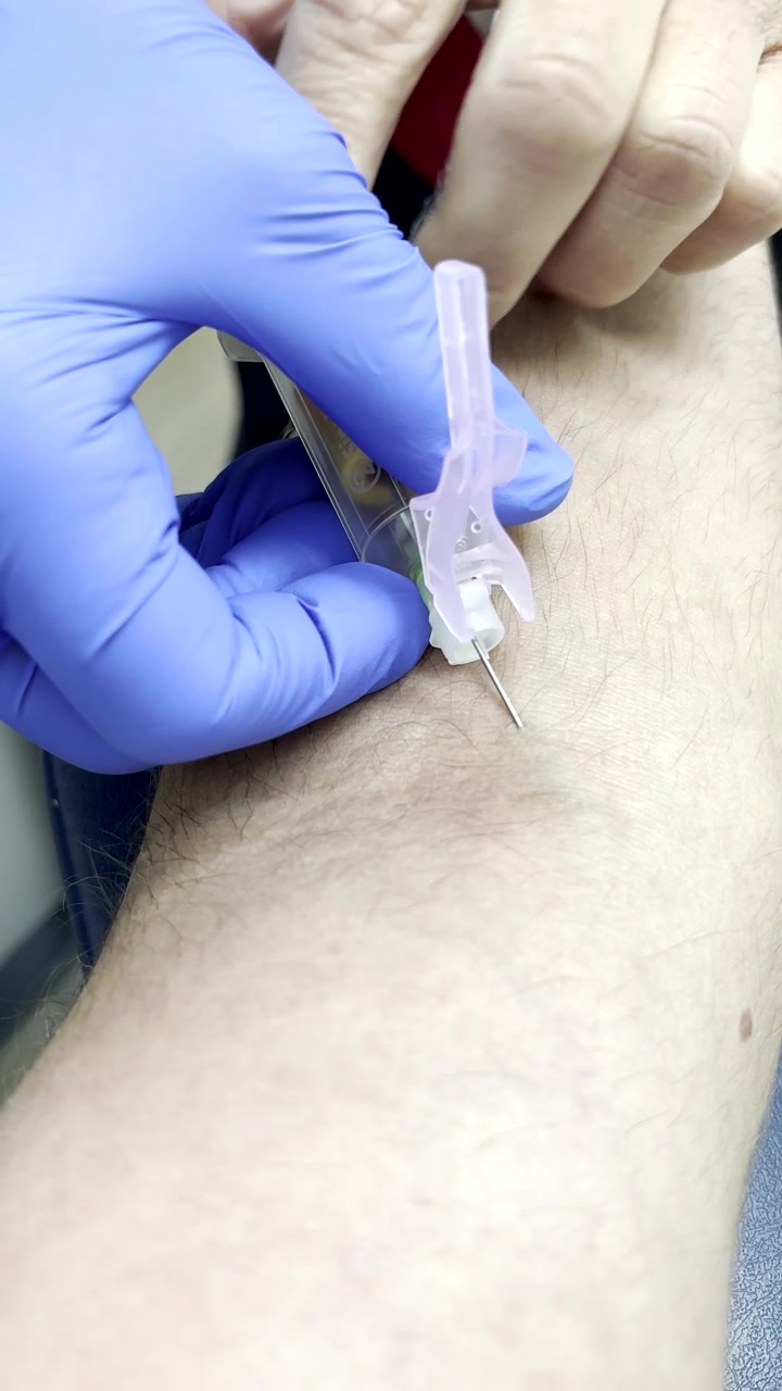 Flebotomista con guanto blu preleva sangue dal braccio. POV paziente verticale